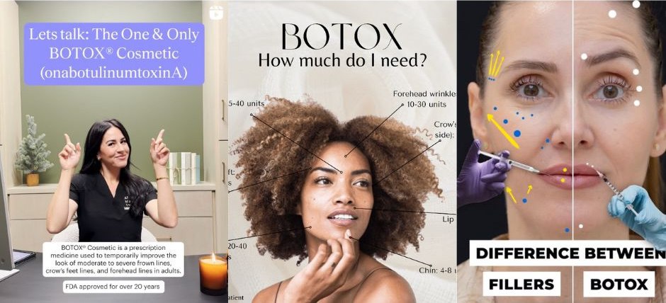 Examples of educational Botox Reels on Instagram and TikTok