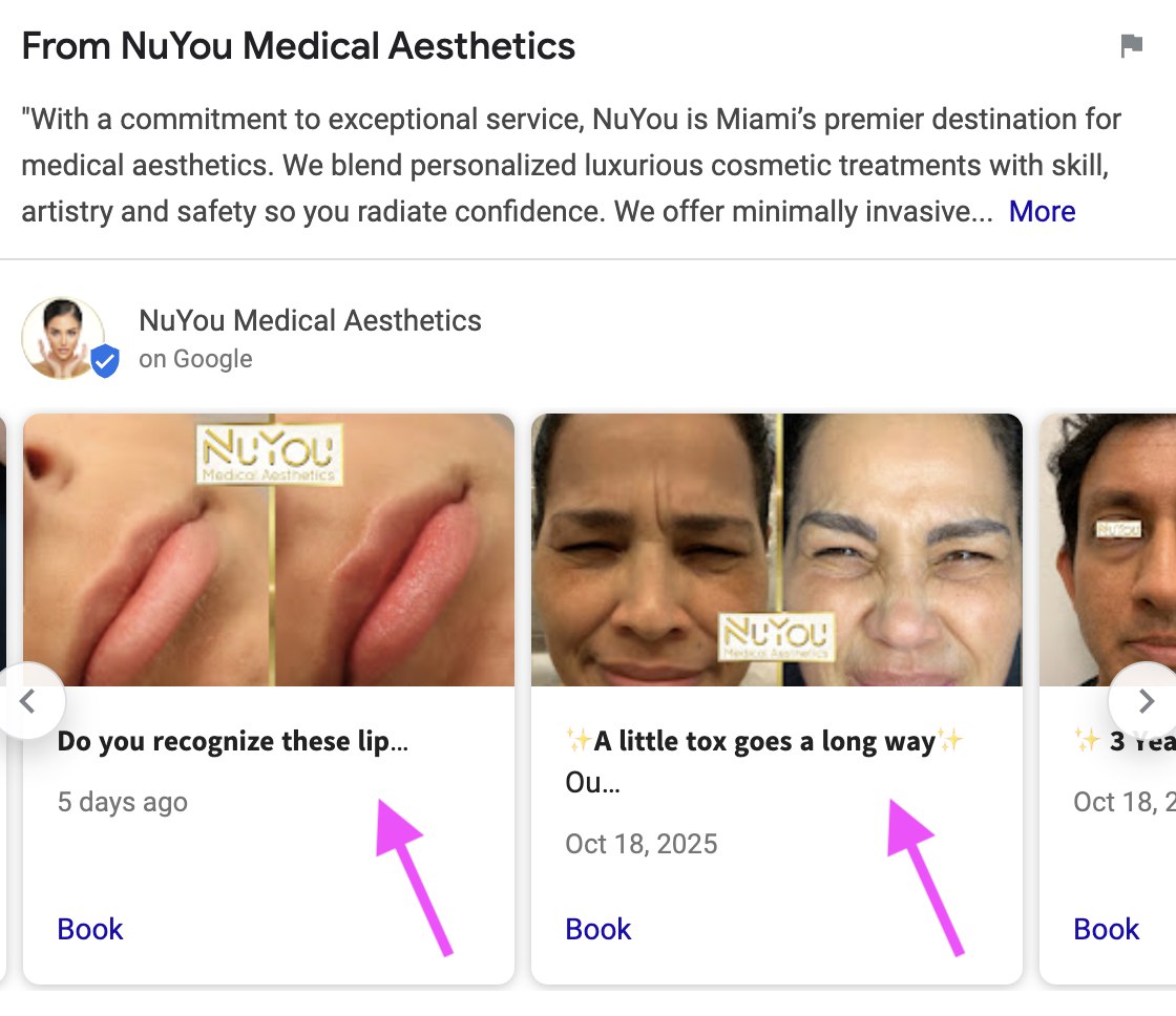 Google Business Profile posts with booking buttons for Botox treatments