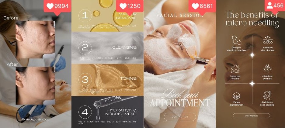 High-performing MedSpa Reels with engagement metrics showing before-after results and skincare education