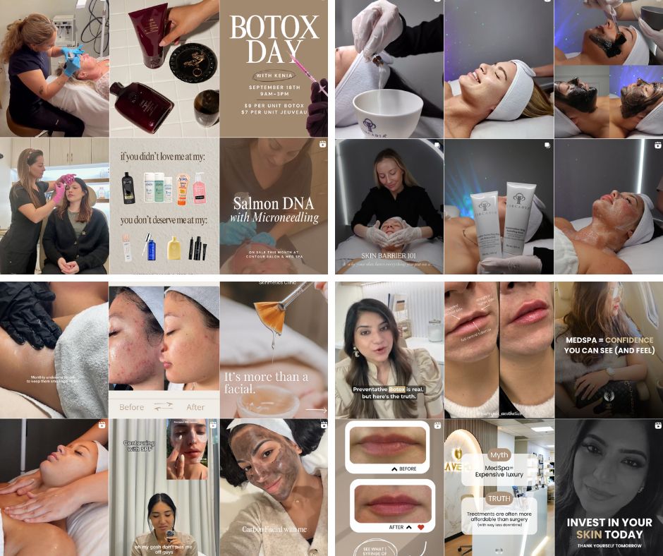 Examples of MedSpa social media content including treatments, before-and-afters, educational posts, and branded graphics